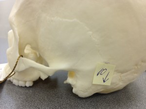 Point 10 is the mastoid process that is viewed from the skull's lateral (furthest part from the middle) position.